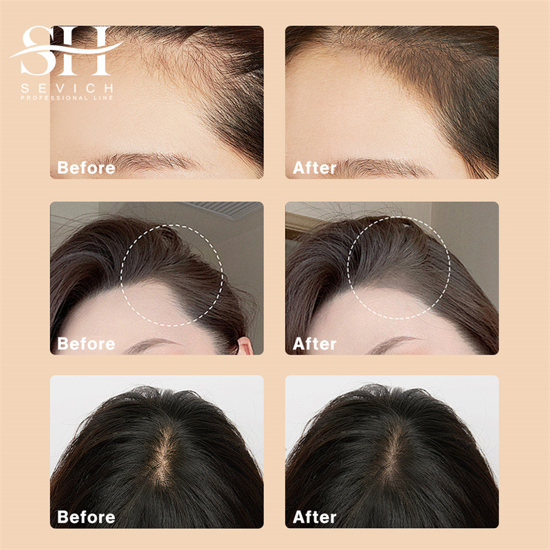 SEVICH 12g Hairline Powder Wit - Rooting Hormone Powder recensie en prijs