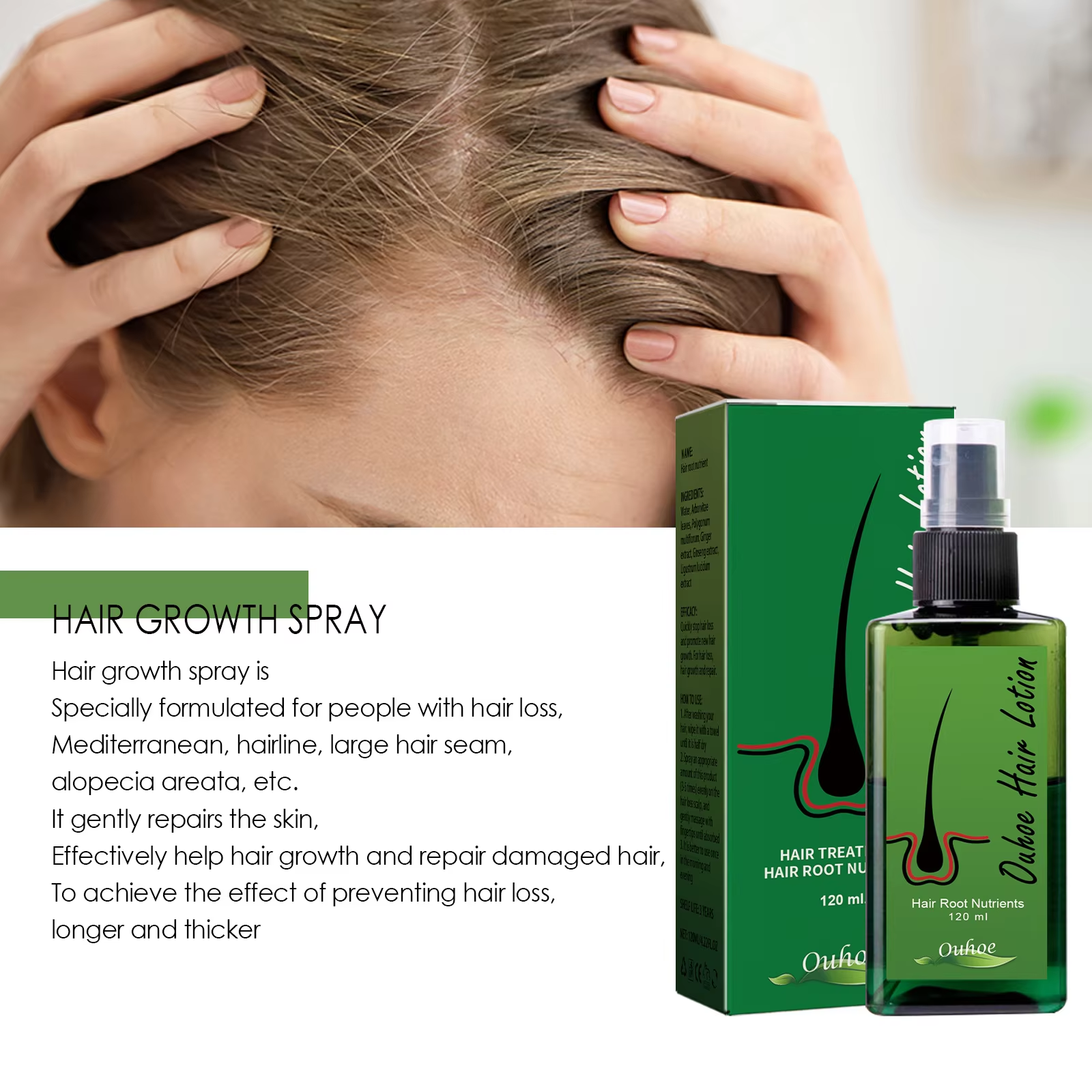 Hair Growth Spray Anti Hair Lo - Root Stimulator Liquid recensie en prijs