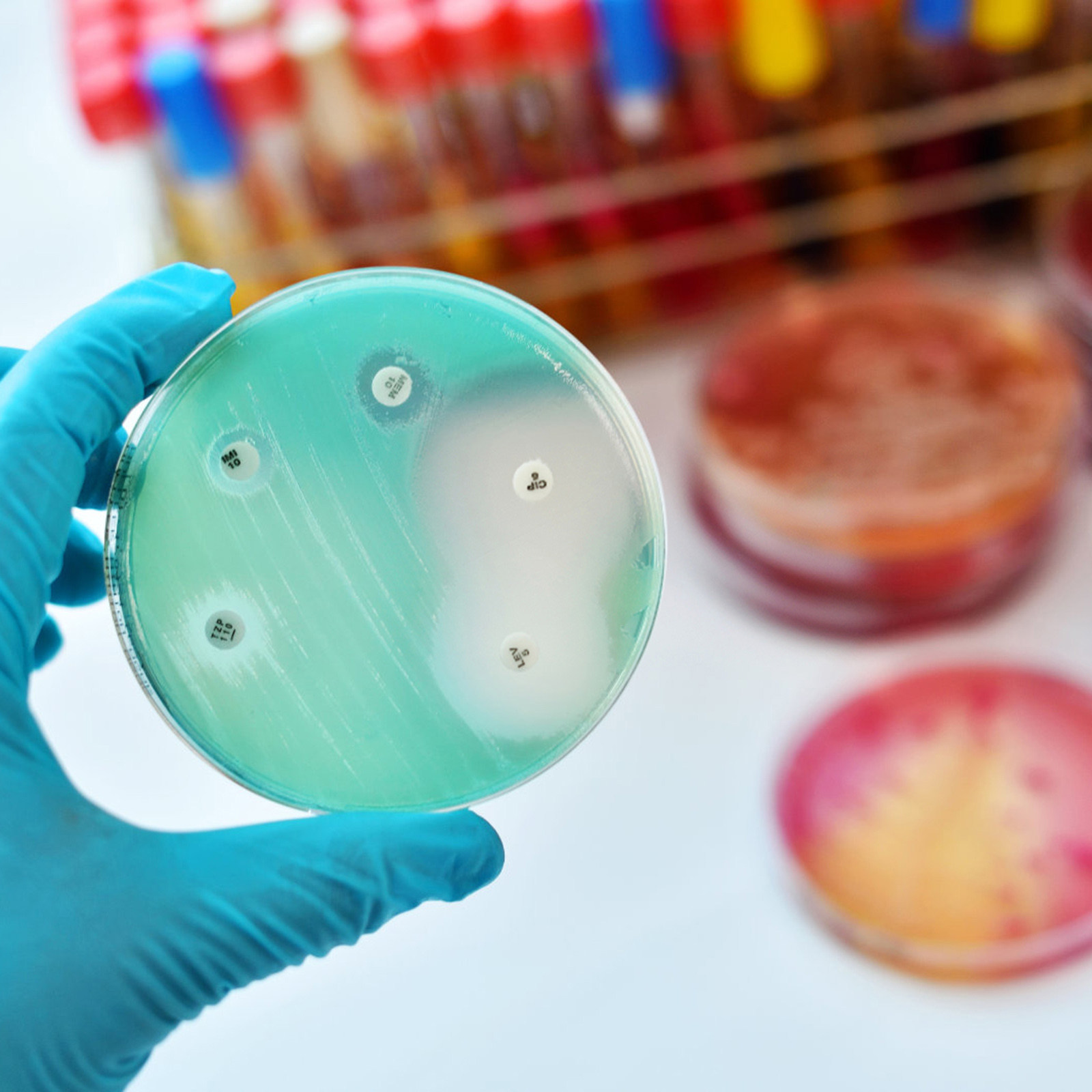 30Pcs Petri Dishes Plastic Cle - Agar Tissue Culture recensie en prijs